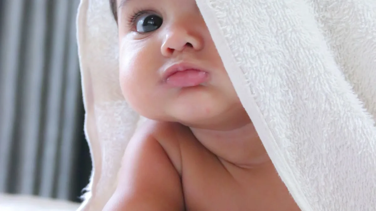 Cradle Cap Treatment: A Guide for Parents